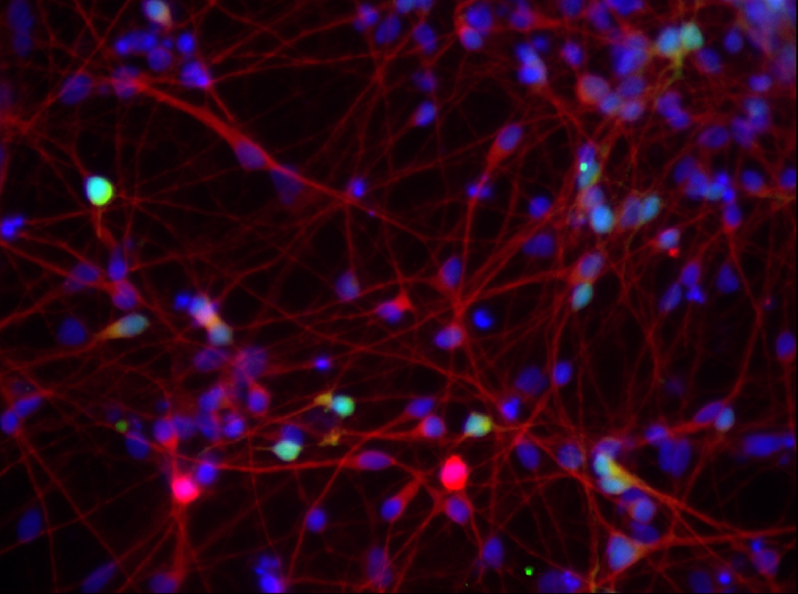 GABA and MAP2 staining