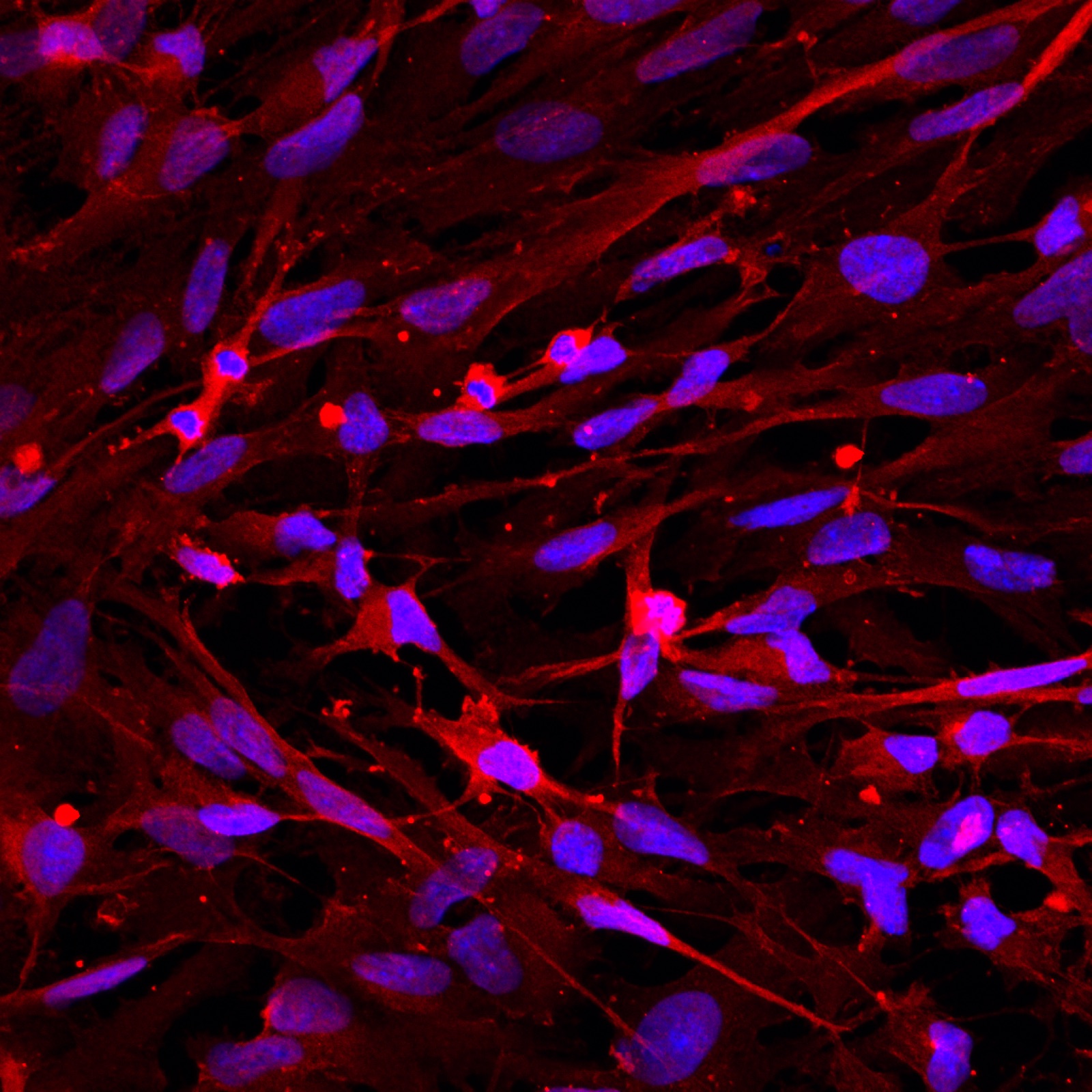 Functional astrocyte marker image