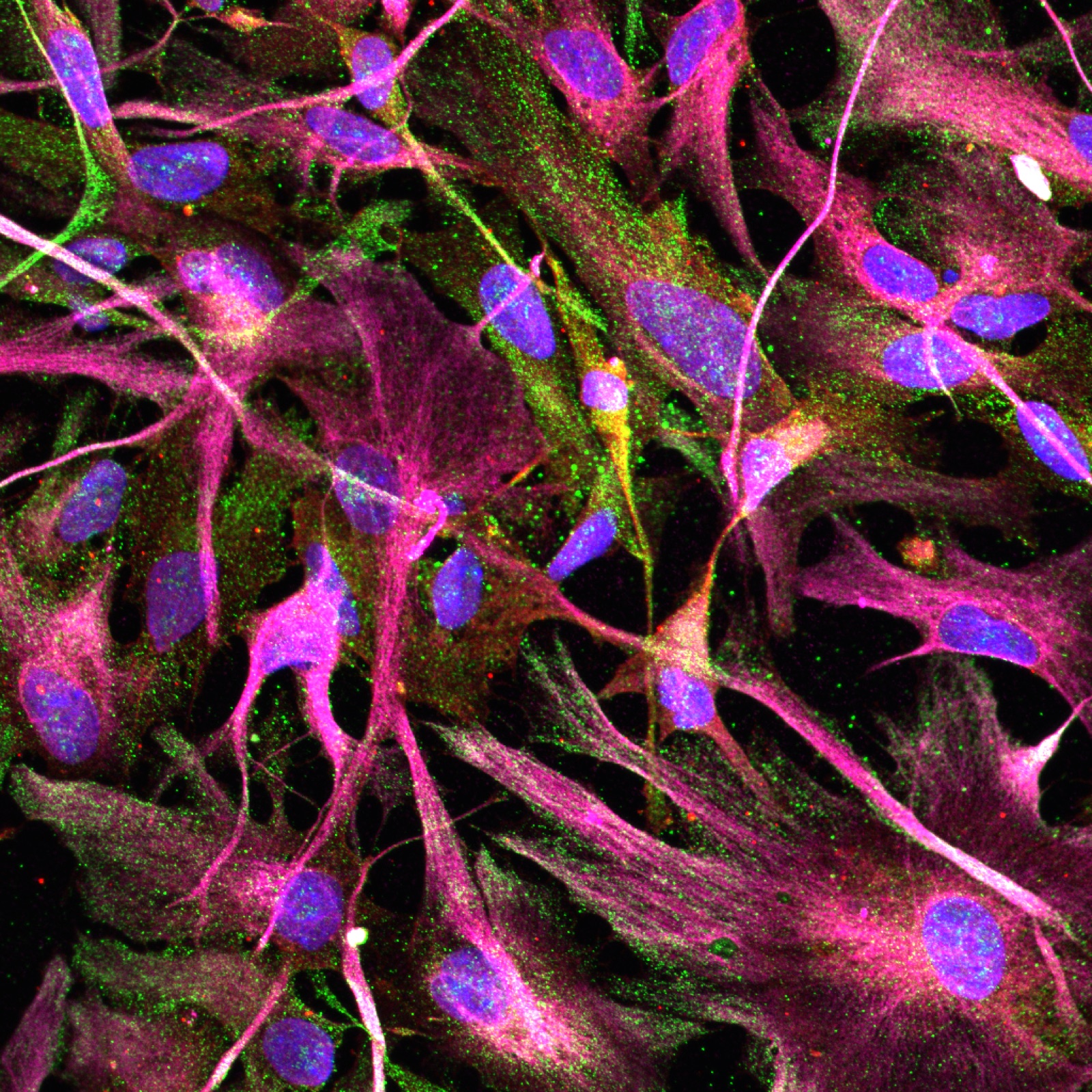 Astrocyte culture image