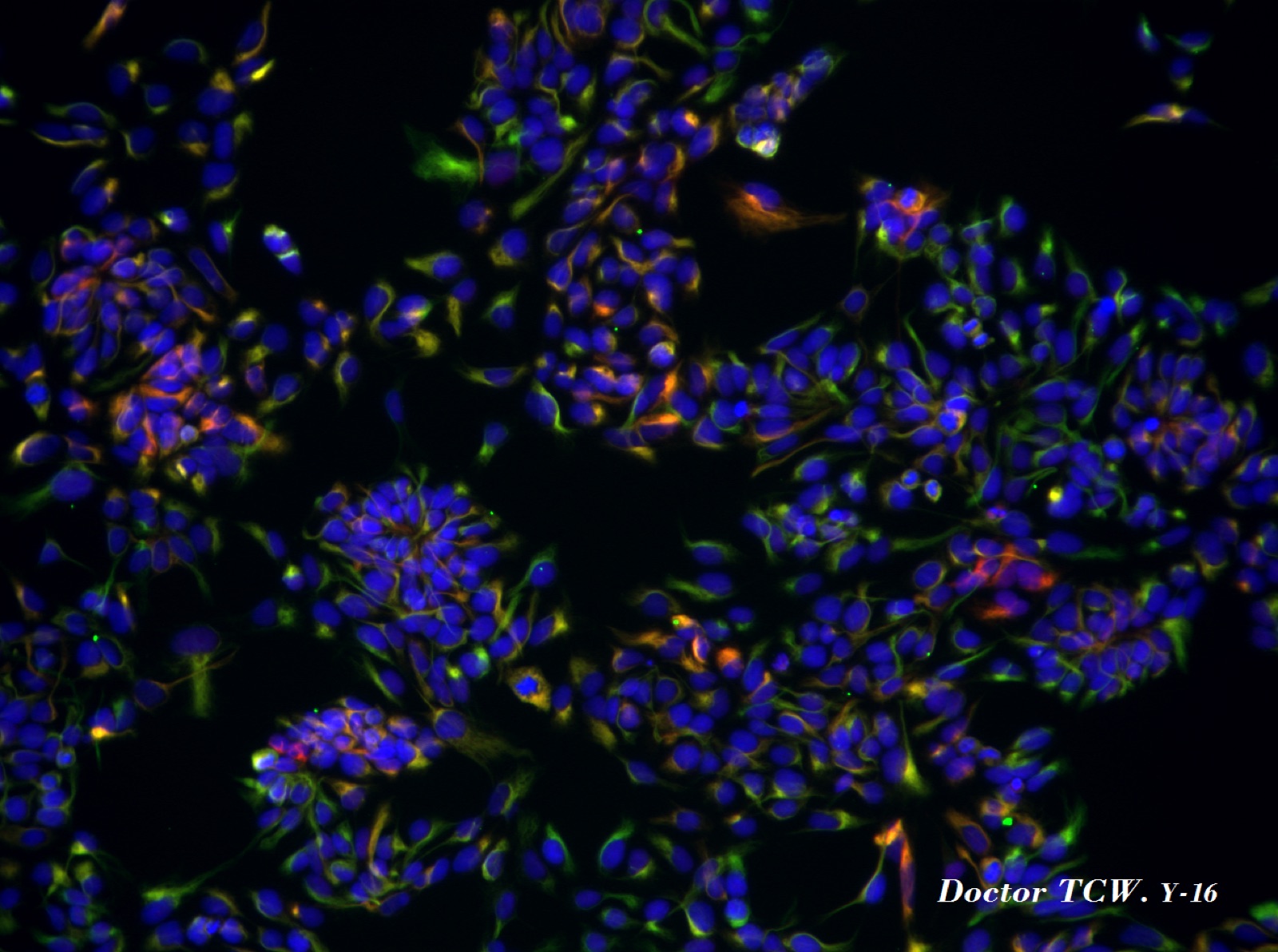 NPC Nestin, FOXP2, and DAPI staining