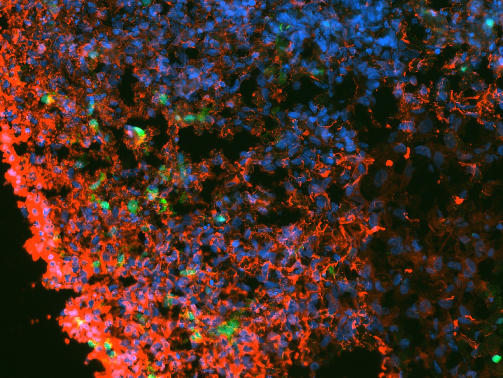Organoid and iMG co-culture image